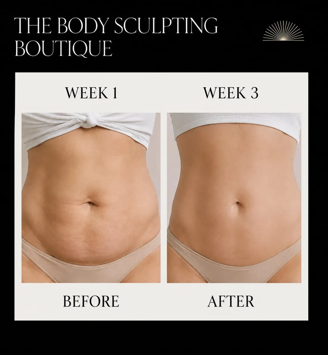 Abdomen · client results, before and after