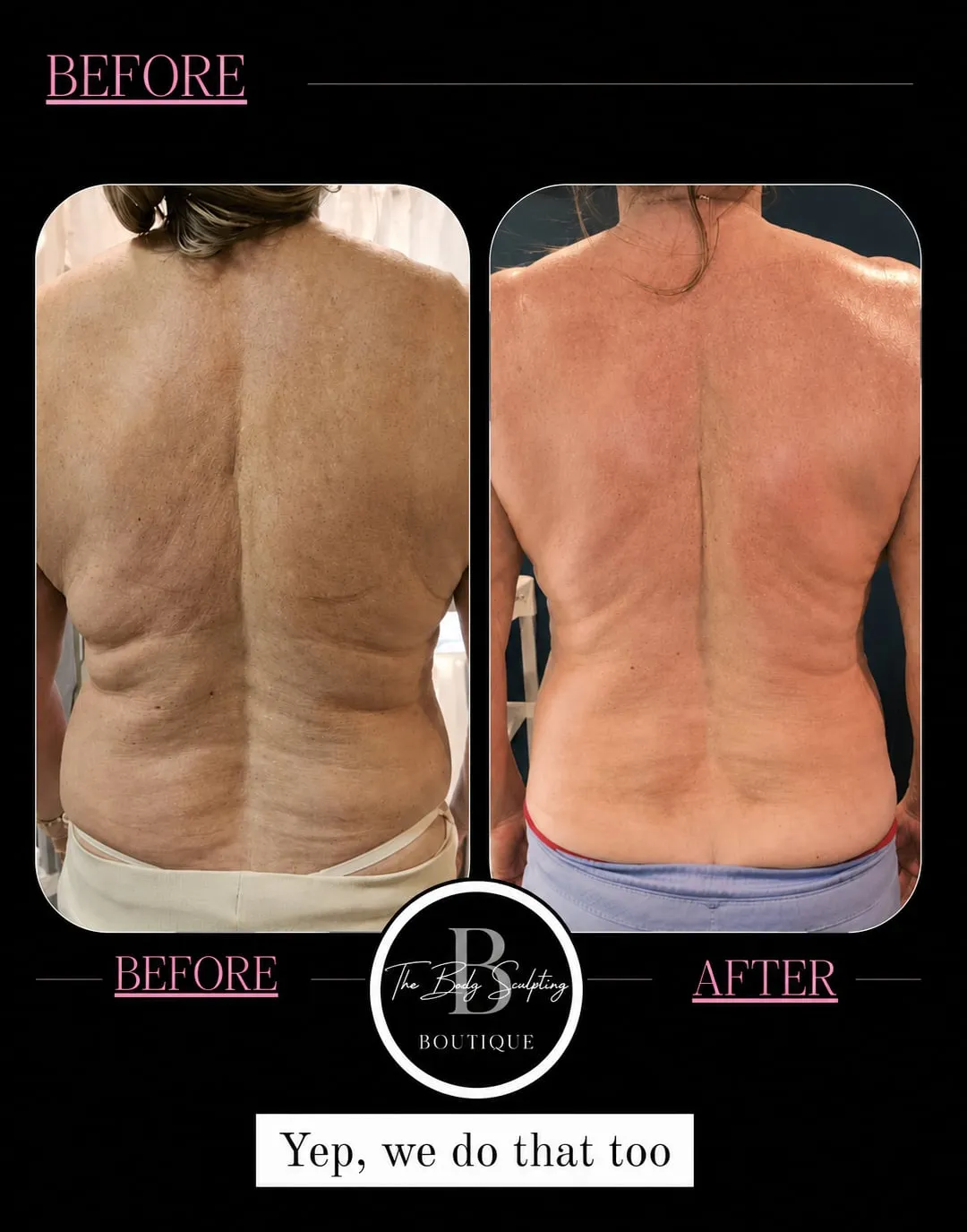 Back · client results, before and after